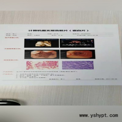 泰福轩实业 医用超声胶片  瓷白胶片 医用打印胶片可定制厂家销售 可咨询